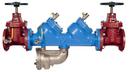 3 in. Stainless Steel 175 psi Backflow Preventer